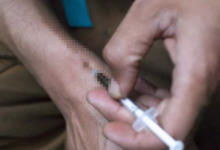 柬卫生部：吸毒者艾滋病感染率最高！